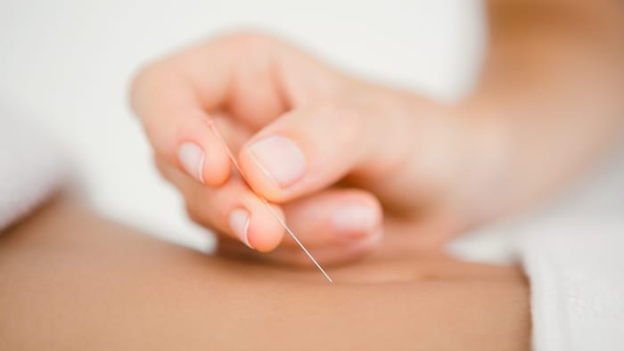 Thin needles with great effectiveness.