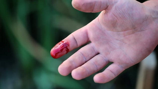 The HIV-positive man stuck his bloody finger into the mouth of a Viennese policewoman. (symbolic image) (Bild: Volodymyr - stock.adobe.com)