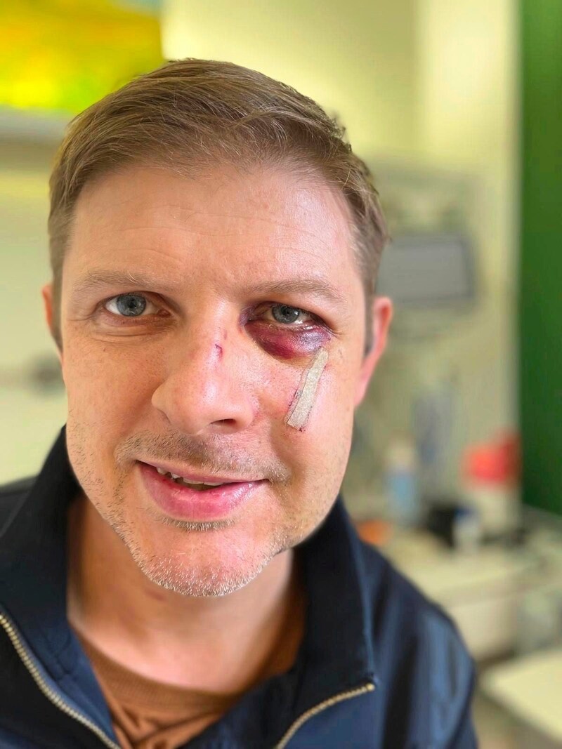 German MEP Matthias Ecke was beaten until he was hospitalized. (Bild: SPD Sachsen/Matthias Ecke)