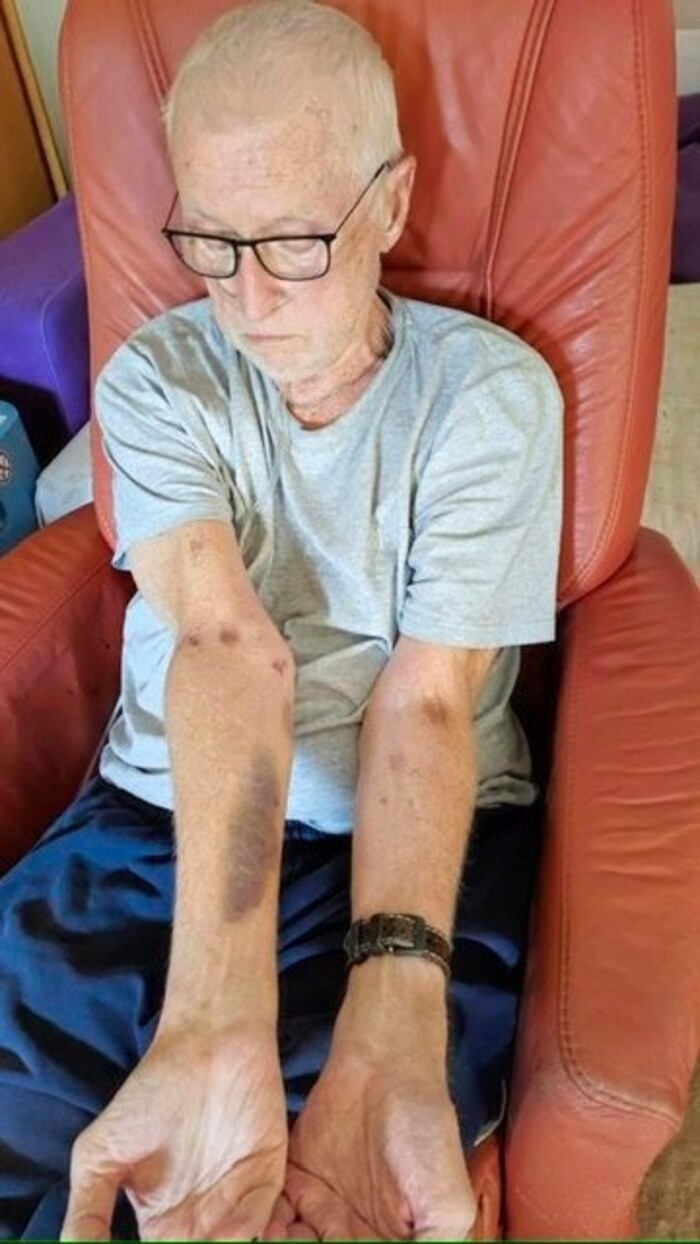 Patient Karl Sch. after the hospital - he doesn't want or need to comment verbally on the seven ...