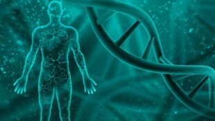 Bei Mukopolysaccharidose fehlt den Betroffenen ein Enzym, wodurch komplexe Zuckerketten nicht ...