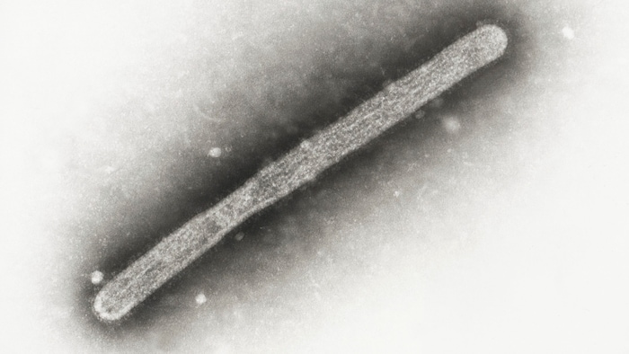 Das H5N1-Virus unter dem Mikroskop