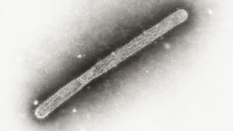 Das H5N1-Virus unter dem Mikroskop (Bild: AP ( via APA) Austria Presse Agentur/AP)