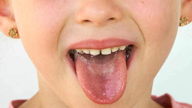 The body produces up to 1.5 liters of saliva every day.