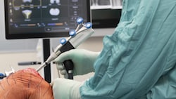 Auf eine neue Hüfte oder ein neues Knie muss man besonders lange warten