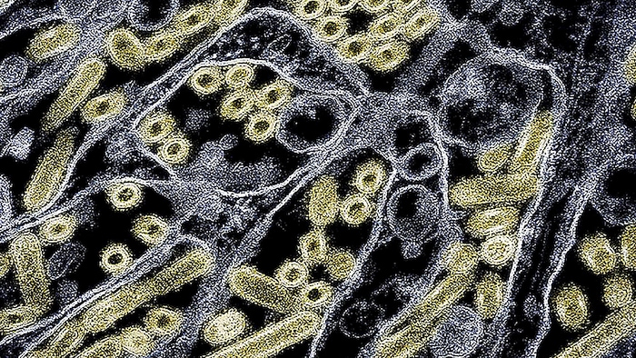 Elektronenmikroskopische Aufnahme des H5N1-Virus mit; die Viruspartikel sind gelb eingefärbt.