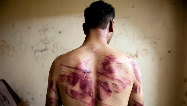 Archivbild aus dem Jahr 2012: Ein syrisches Folteropfer (Bild: APA/AFP/JAMES LAWLER DUGGAN)