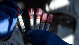 Das Corona-Virus ist nach wie vor in Wellen unterwegs.