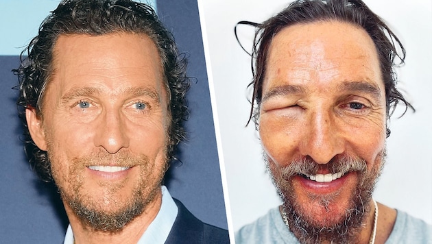 Matthew McConaughey sieht plötzlich ganz anders aus.  (Bild: Krone KREATIV/Getty Images via AFP/GETTY IMAGES/Amy E., www.instagram.com/officiallymcconaughey)