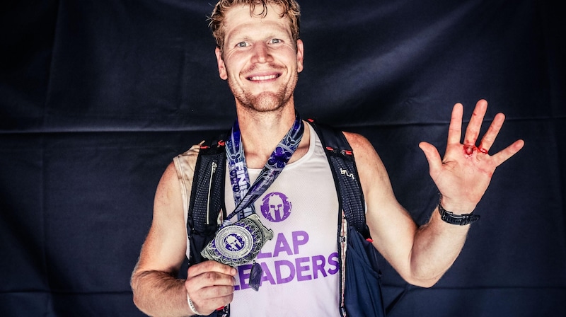 Hofstätter with the medal and wounds.medal (Bild: zVg)