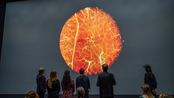 You can enlarge the organs endlessly and the image always remains sharp.