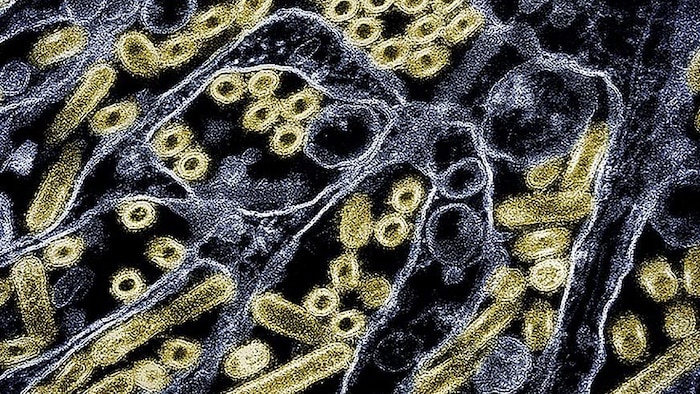 Das Vogelgrippevirus H5N1 