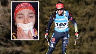 Juliane Frühwirt hatte einen schweren Unfall, bei dem sie sich sogar einer ...