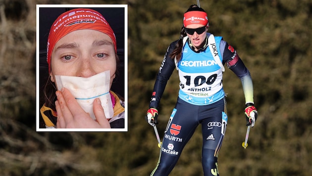 Juliane Frühwirt had a serious accident in which she even had to undergo a tongue transplant. (Bild: GEPA; www.instagram.com/jule_fruehwirt98)