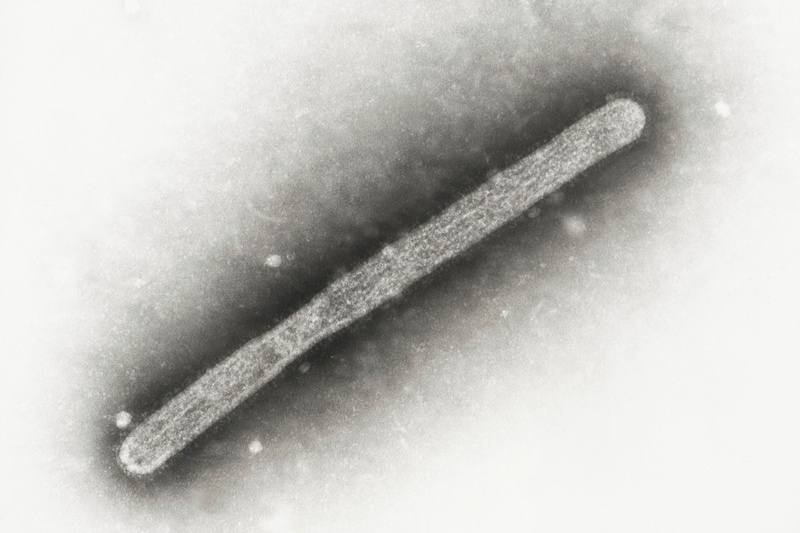 The H5N1 virus under the microscope (Bild: AP)