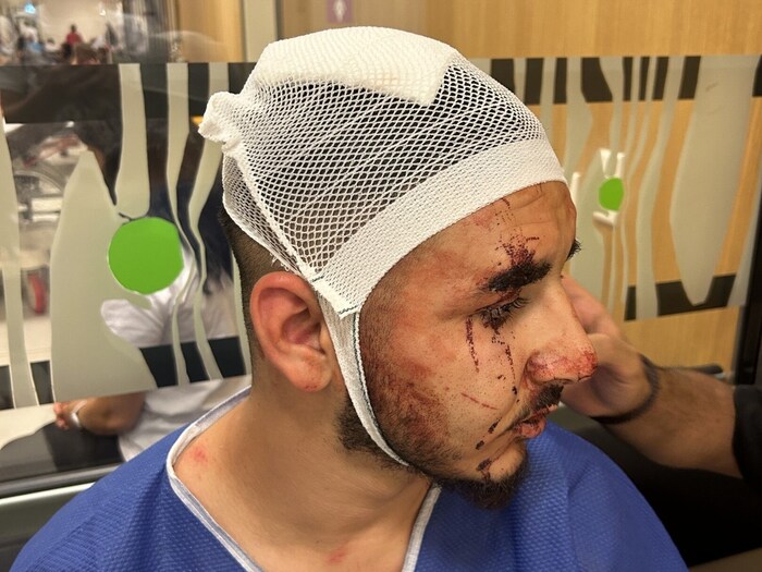 The masked men left the seriously injured man on the ground and fled.
