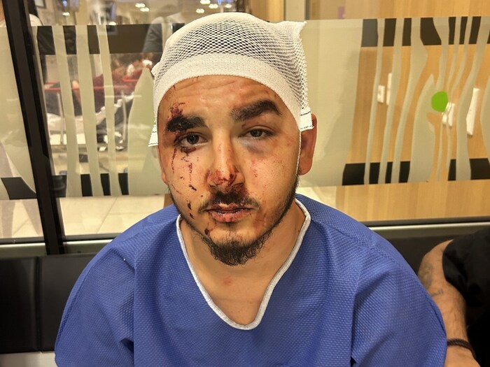 The masked men left the seriously injured man on the ground and fled.