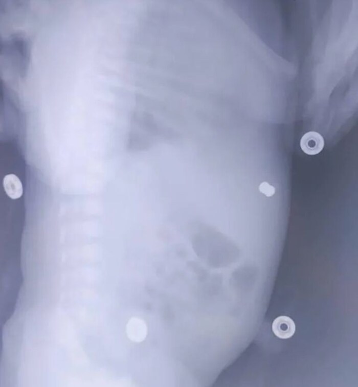X-ray of the child