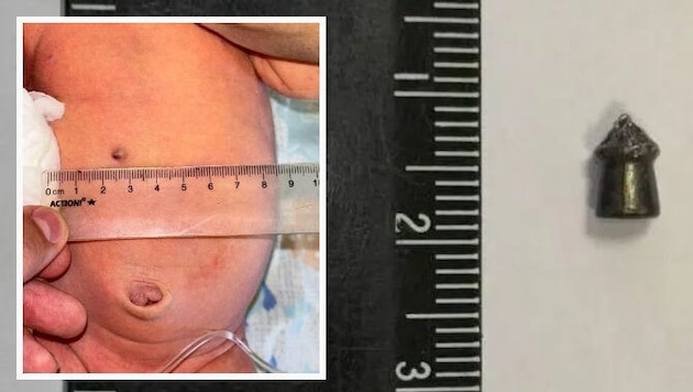 The bullet lodged in the baby's body was around one centimeter in size. (Bild: Krone KREATIV)