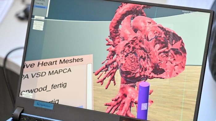 Die Darstellung in VR hingegen erlaubt, an jeder beliebigen Stelle einen Querschnitt ...