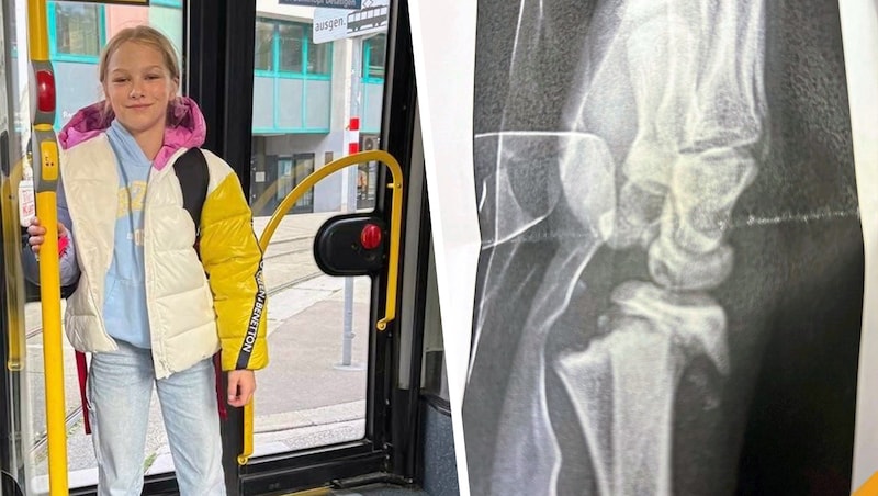 Larissa was standing in the crowded bus when the door broke her arm. (Bild: zVg, Krone KREATIV)