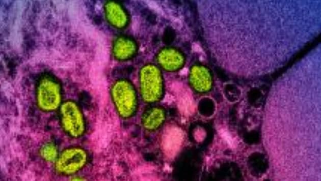 This is what the pathogen looks like under the microscope. (Bild: APA/AFP/National Institute of Allergy and Infectious Diseases/Handout)