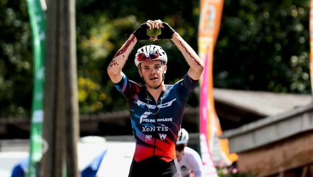 Covered in blood, Emanuel Zangerle finished second in the Gravel ÖMS. (Bild: Cian Baumgartner)