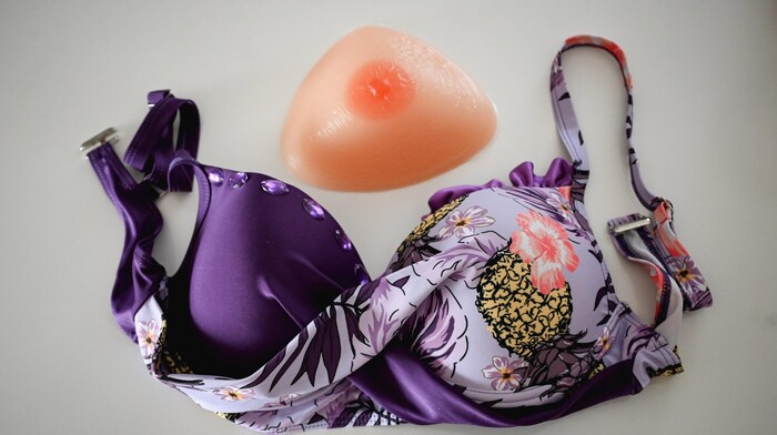 Theresia Kaun bought a silicone breast from a sex store and sewed it into her bikini.
