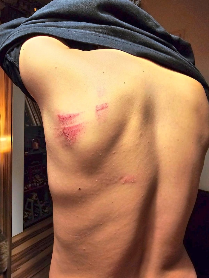 A Kirtag visitor suffered injuries as a result of the scuffle in front of the wine tavern.