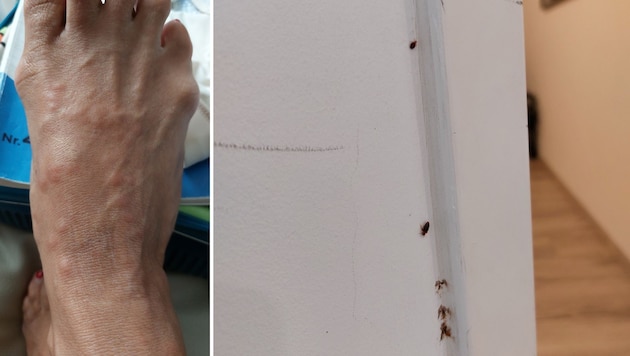 The victim documented her bedbug bites, as well as the pests on the walls. (Bild: zVg, Krone Kreativ)