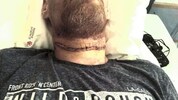 So sah der 43-Jährige nach dem Mordversuch aus.
