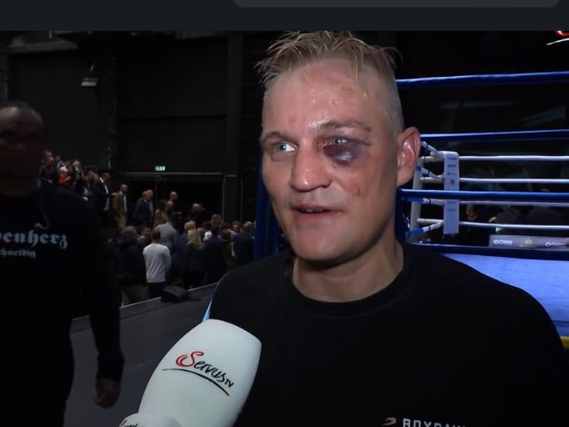 David Kerkmann was marked after the fight. (Bild: Servus TV)