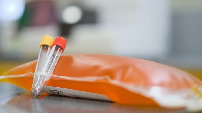 The plasma is "collected" from the blood.