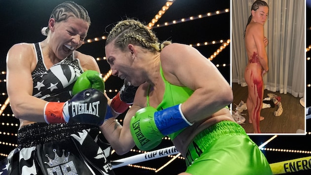 Sandy Ryan (left) was the victim of a paint attack and then also lost the world championship fight against Mikaela Mayer. (Bild: AP/Frank Franklin II)