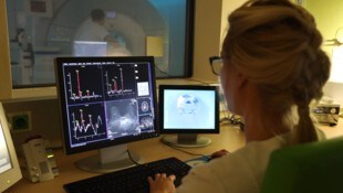Das Forscherteam erarbeitete eine Methode zur schnellen Früherkennung von Brustkrebs.