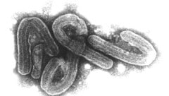 Mikroskopische Aufnahme des Marburg-Virus, das das Marburgfieber auslöst. (Bild: APA/dpa/Bernhard-Nocht-Institut)