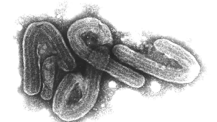Eine elektronenmikroskopische Aufnahme des Marburg-Virus