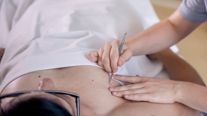 The patient's scar was decongested, blood circulation stimulated and sensitivity improved.