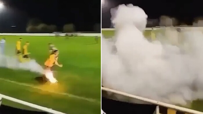 Fabio Schiafino wollte den Böller wegwerfen, als dieser plötzlich explodierte.