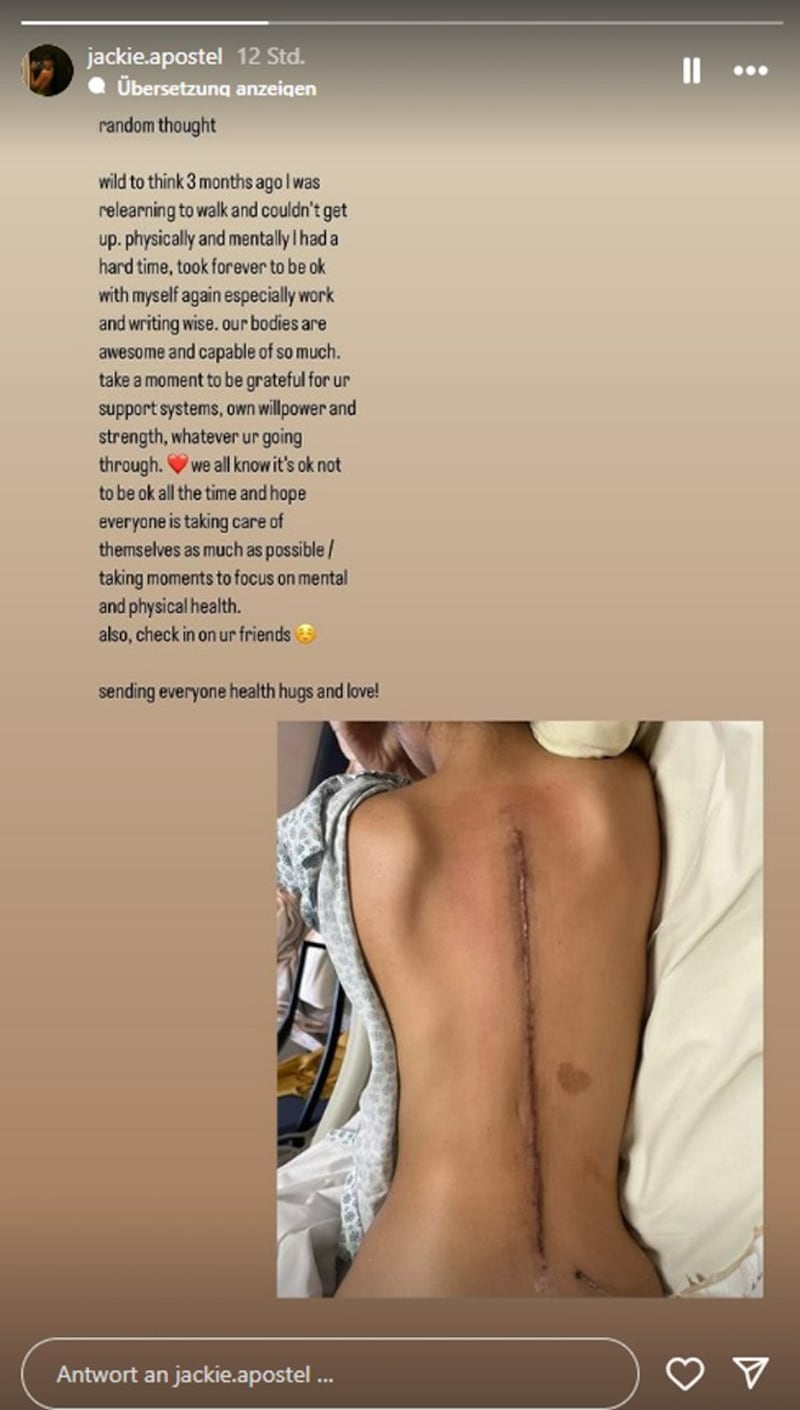 In her message, Cruz Beckham's friend Jackie Apostel revealed that she had to learn to walk and stand up again three months ago. (Bild: instagram.com/jackie.apostel)