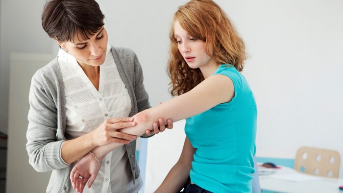 The appropriate treatment for this unpleasant skin condition is discussed with the doctor.
