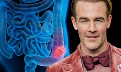 „Dawson‘s Creek“-Star James Van der Beek (47) ist an Darmkrebs erkrankt.