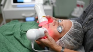 Eine Laser-Behandlung mit Hyaluron. (Bild: Wenzel Markus/Markus Wenzel)