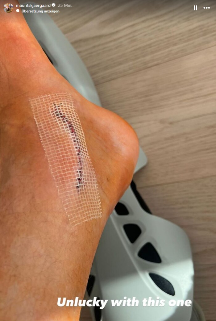 Kjaergaard stellte ein Bild von seiner Narbe auf Instagram.