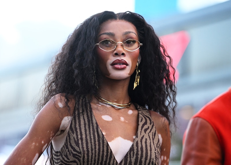 The model with the pigment-free spots Winnie Harlow (30) was also there. (Bild: APA/Getty Images via AFP/GETTY IMAGES/Rudy Carezzevoli)