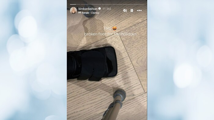 Kardashian machte keine Angaben, wie es zu der Verletzung kam.