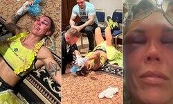 Mikaela Lauren wurde bei der „Bounce Fight Night“ ganz „schön“ zugerichtet.