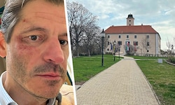 „Ich habe Fehler gemacht“, schreibt Koza jetzt in einer persönlichen Erklärung.