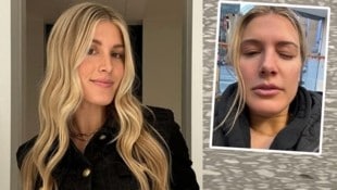 Das linke Auge von Eugenie Bouchard ist dick geschwollen. (Bild: instagram, x, krone.at-grafik)