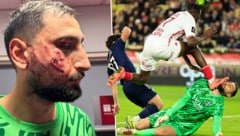 Gianluigi Donnarumma was badly hit. (Bild: AFP/Valery HACHE, x.com/ArthurPerrot)